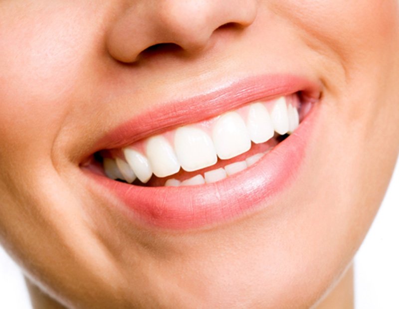 Close-up of woman’s smile after treatment with BioClear in Portland