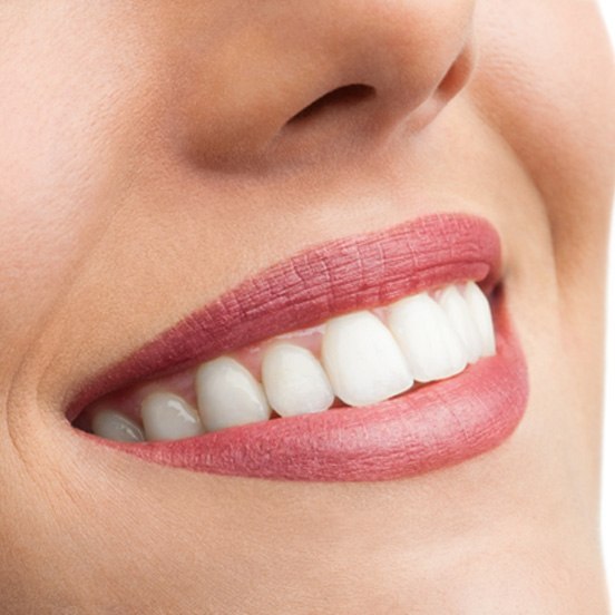 Close-up of woman’s beautiful smile after successful BioClear treatment