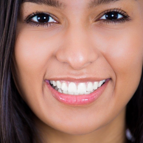 Woman's perfected smile after makeover