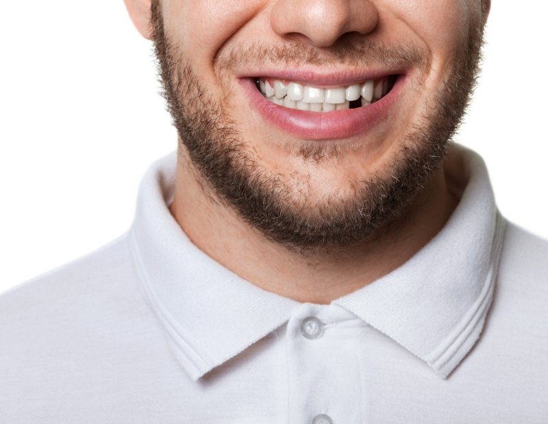 Closeup of smile with missing bottom tooth